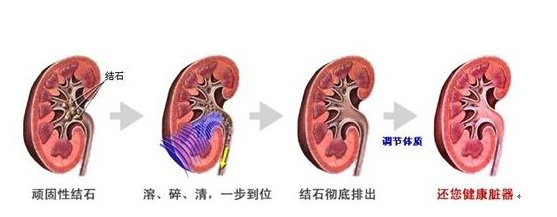 QQ截图20170919154114.png